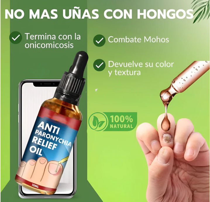 Tratamiento para eliminar Hongos de uña 100% Natural🍃