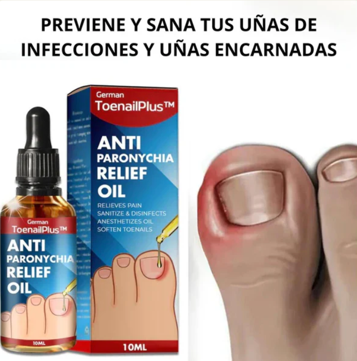 Tratamiento para eliminar Hongos de uña 100% Natural🍃