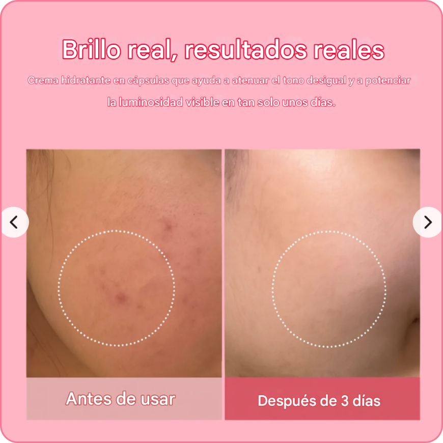 Crema en cápsulas de colágeno PDRN Koaluxe™ | Andres